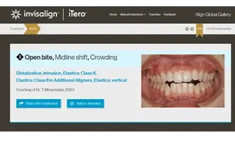 グローバルギャラリー受賞（一例）