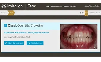 グローバルギャラリー受賞（一例）