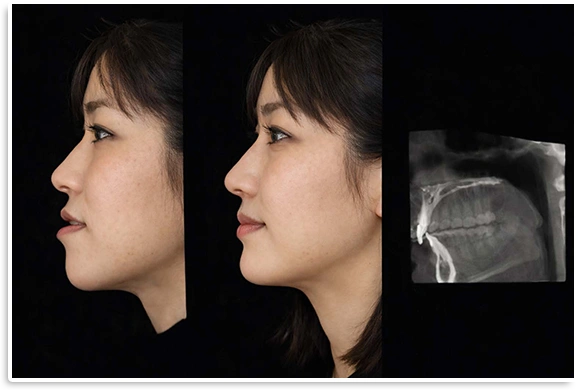 3Dフェイススキャンによる表情・顔貌の立体解析