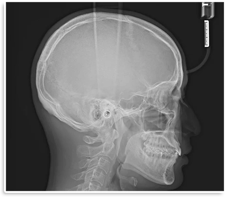 頭部・顎骨の評価
                    